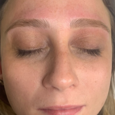 Cosmetic Tattooing After