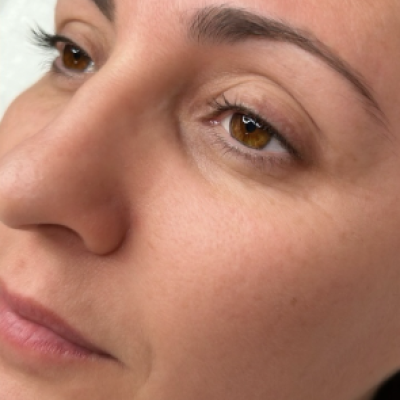Cosmetic Tattooing Before 1
